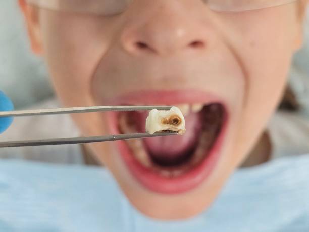 Best Emergency Tooth Extraction  in Sterling Heights, MI